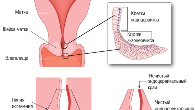 Photo of Как выбрать правильное место